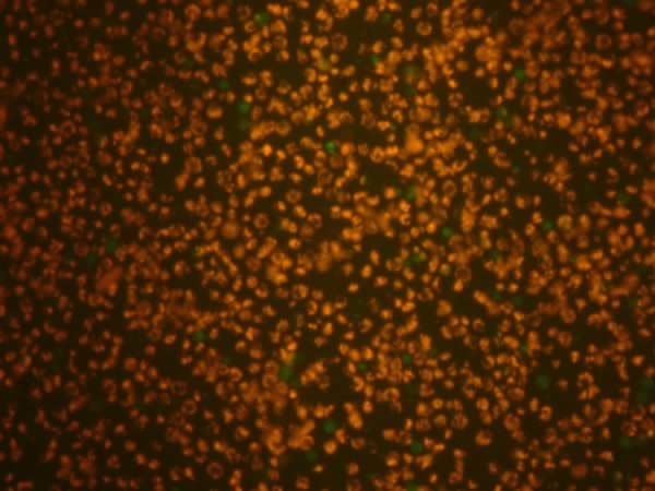 Zdjęcie - Komórki pod mikroskopem